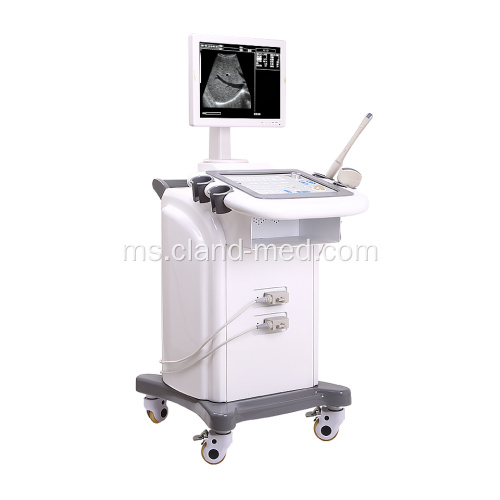 B / W Trolley Ultrasound Pengimbas Mesin Ultrasound Harga Baik